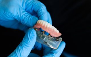 Prótesis de dentadura.